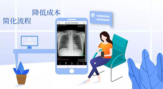 云膠片什么時候能普及?他的發(fā)展受到哪些限制?